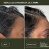 Scalp Care Density Serum by Living Proof for Women -