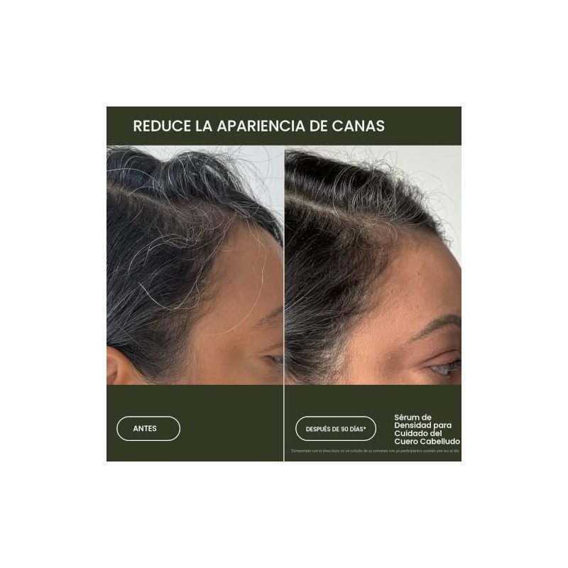 Scalp Care Density Serum by Living Proof for Women -