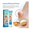 Crema Para Lipoma Lipolisis Celulitis 20g Neutra