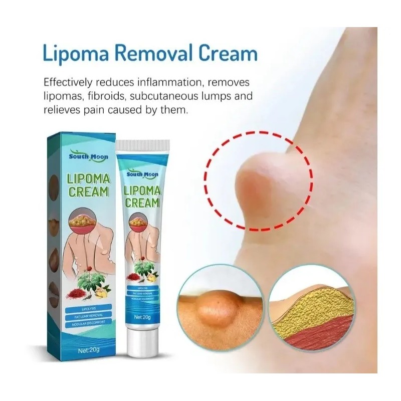 Crema Para Lipoma Lipolisis Celulitis 20g Neutra