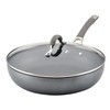 Circulon Elementum Hard Anodized Nonstick Deep Frying Pan/Skillet with Lid,