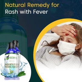 Rash with Fever Natural Remedy (BM171) Blue