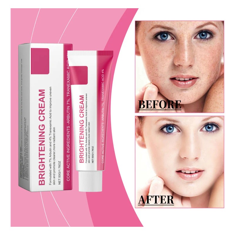 Crema Facial Despigmentante 50g Hidratante Antimanchas