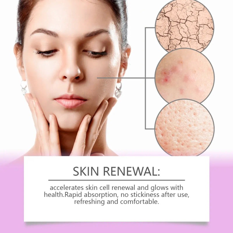 Ouhoecrema Facial Cuidado Acné Ácido Azelaic