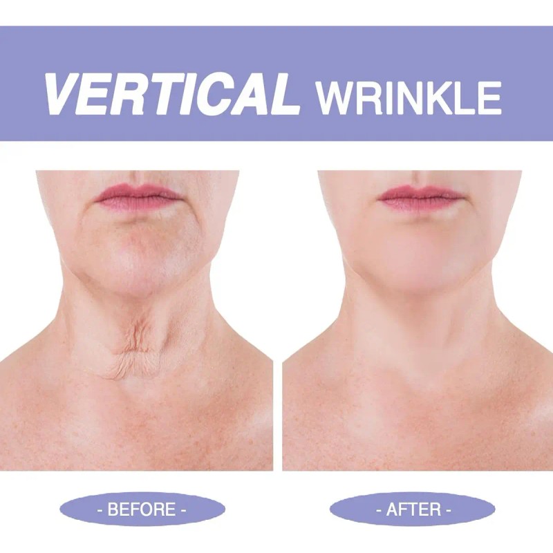 Crema Reafirmante Para El Cuello Y La Clavícula,colageno