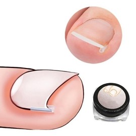 Toenail care curve stick 50pcs / 발톱관리 커브스틱 50pcs