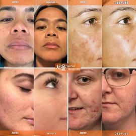 SEOUL CEUTICALS suero facial vitamina C con ácido ferúlico y ácido hialurónico - 30 ml