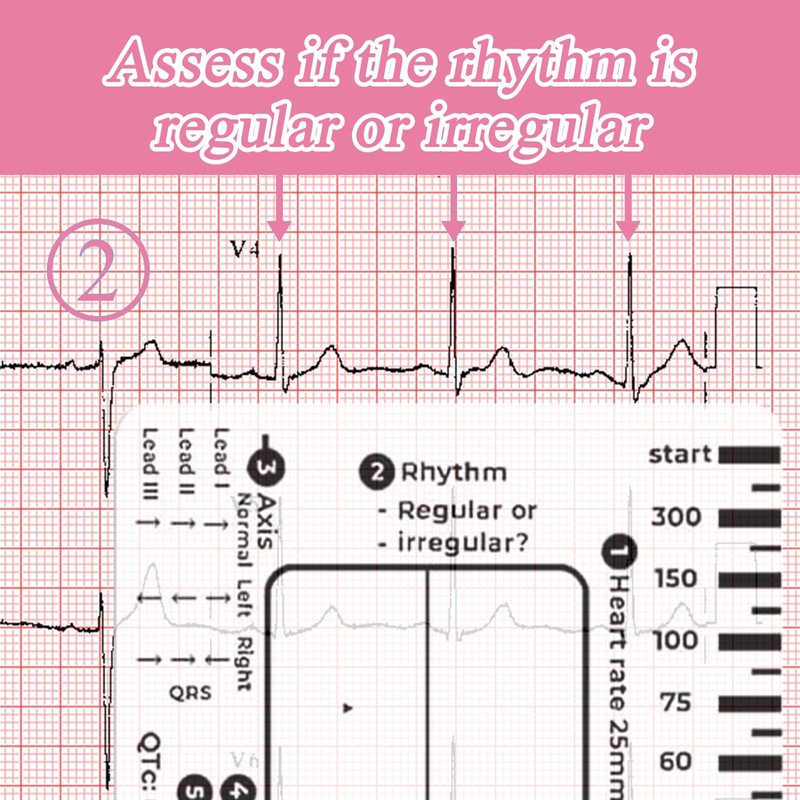 Ecg 7 Step Ruler, Ecg/Ekg 7 Step Ruler Card, Portable