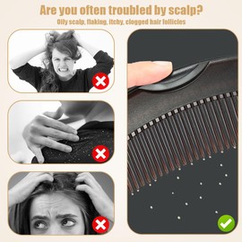 LOPHE Dandruff Comb, Pack of 2 Scalp Comb, Birth Comb Set, Energy Massage Comb with Handle, Dandruff Comb for Scalp Cleansing, Dandruff and Dirt