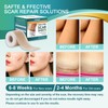 Medical Grade Silicone Scar Sheets, Silicone Scar Tape (1.6”x 60”