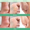 Mascarilla Peeling Para Pies - Extracto De Melocotón + Aloe