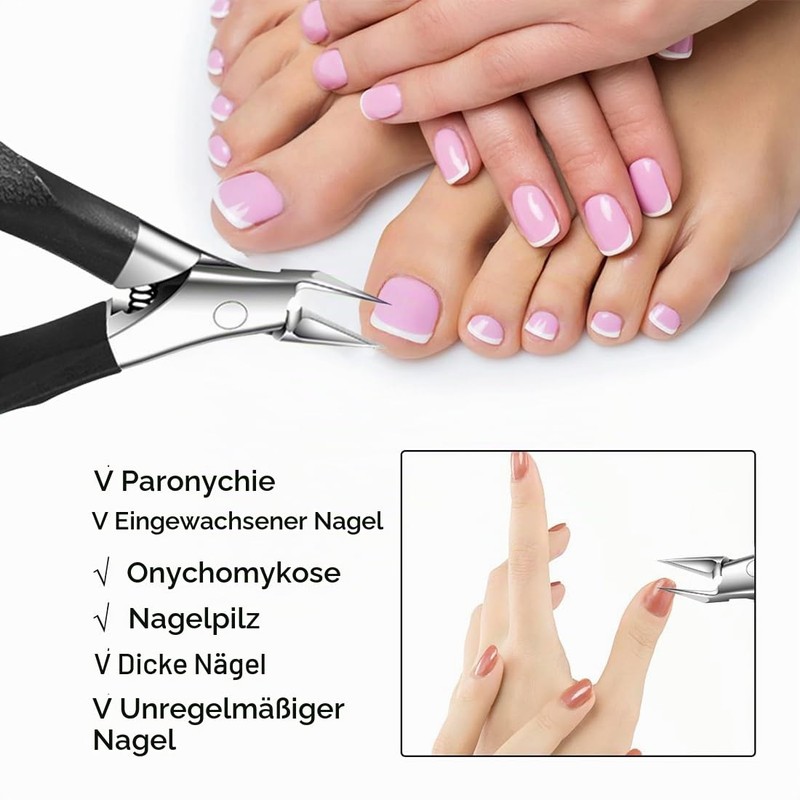 Nail Scissors for Deep Ingrown Toenails Made of Stainless Steel,