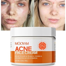 MOOYAM Herbal Acne Removal Cream – 100g Moisturizing Face Gel for Pimples, Oil Control, Shrinking Pores & Clear Skin Care