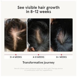 iRestore Hair Growth Supplement - Hair Loss Vitamins for Women and Men - Biotin Multivitamins & DHT Blocker to Reduce Hair Thinning - Hair Regrowth Pi