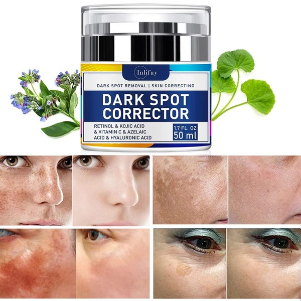 Inlifay Dark Spot Remover for Face Hyperpigmentation Treatment. Dark Spots, Melasma, Freckle, Sun Spots Removal Dark Spot Corrector Cream for Women and Men