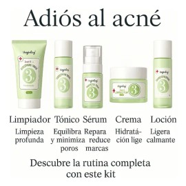 Kit Completo Antiacné 5 En 1 | Serum Crema Tónico | Vogirlog