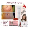 Gel Masaje Paprika Chile Flacidez Celulitis 150ml Mentol
