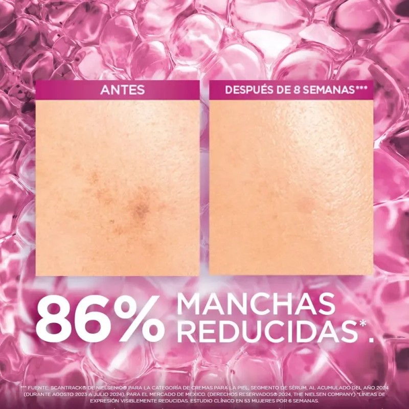 Kit Gel De Limpieza, Sérum Y Crema Día Antimanchas L'oréal