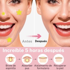 🔥 300pzs mascarillas estrella para el acne espinillas granos  Vitaminas y Minerales