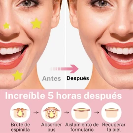 🔥 300pzs mascarillas estrella para el acne espinillas granos  Vitaminas y Minerales