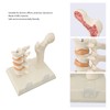 Osteoporosis Spine Model for Teaching and Demonstration, Visualize Bone Density