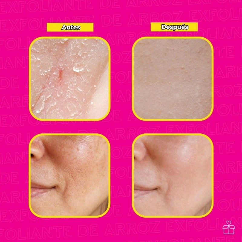 Exfoliante Axiu Gel de Arroz Hidratante Aclarante 200ml Todo Tipo