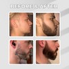 Abera GINB PRO Beard Serum - Beard Growth Serum -