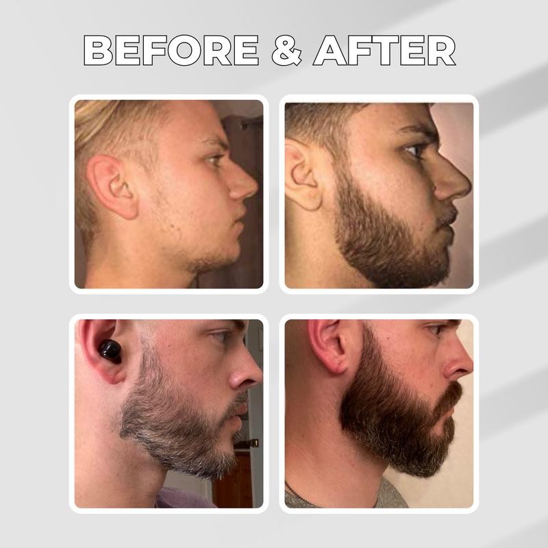 Abera GINB PRO Beard Serum - Beard Growth Serum -