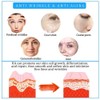 Salicylic Acid Concentrate Super Strong 2% - Acne Spot Treatment