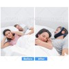 Anti-Snoring Chin Strap - Effective Sleep Solution for Snorers, Comfortable