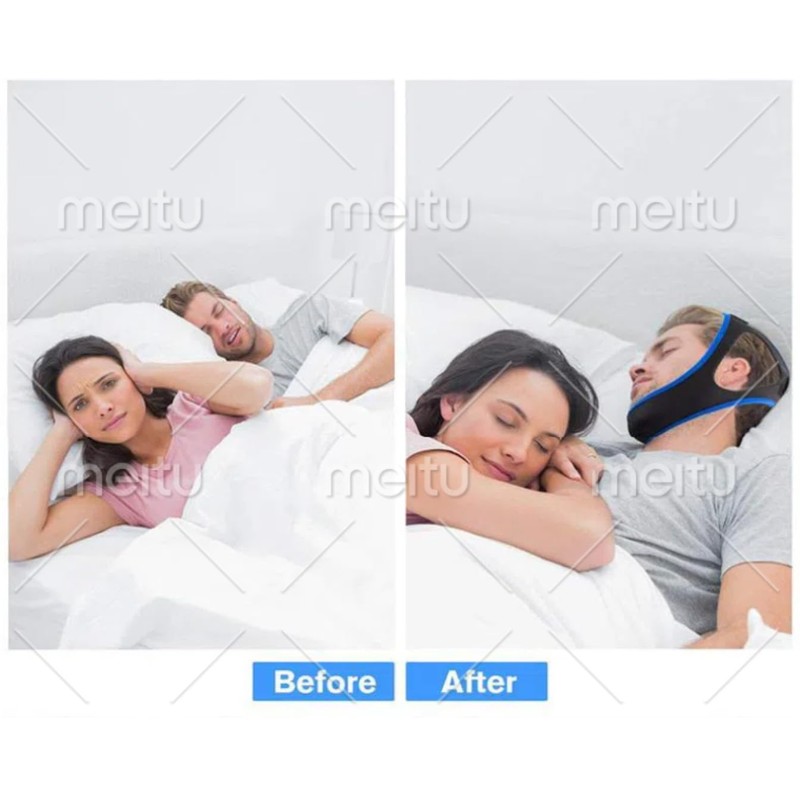 Anti-Snoring Chin Strap - Effective Sleep Solution for Snorers, Comfortable