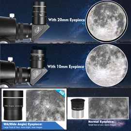 1.25" Telescope Accessory Upgrade Kit with 2 Premium Eyepieces, 2X Barlow Lens, 90° Diagonal Mirror & Phone Adapter, Astronomy Accessories for Sharper Moon Viewing, Planet Observation and Stargazing