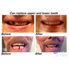 Instant Smile MULTISHADE Patented Temporary Tooth Repair Kit. A Realistic
