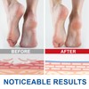 2 pieces urea cream, 60% urea cream, 60% foot care