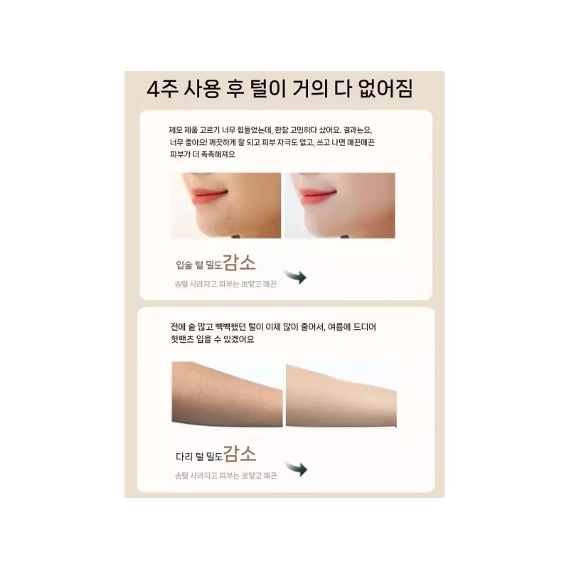 MYU Partners 실면도기 모근 솜털 가정용 페이스 얼굴 제거기 잔털