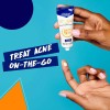 Clearasil Benzoyl Peroxide Stubborn Acne Spot Treatment Cream, 1 oz,