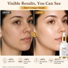 Snail Mucin Serum for Face, Hydrating Serum for Face with