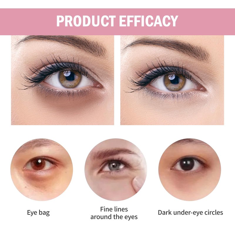 Thoquene 2 x 100 g jasmine ointment eyes, jasmine ointment,