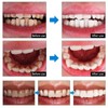 Professional LED Teeth Whitening Kit, Home Treatment System with Remineralization