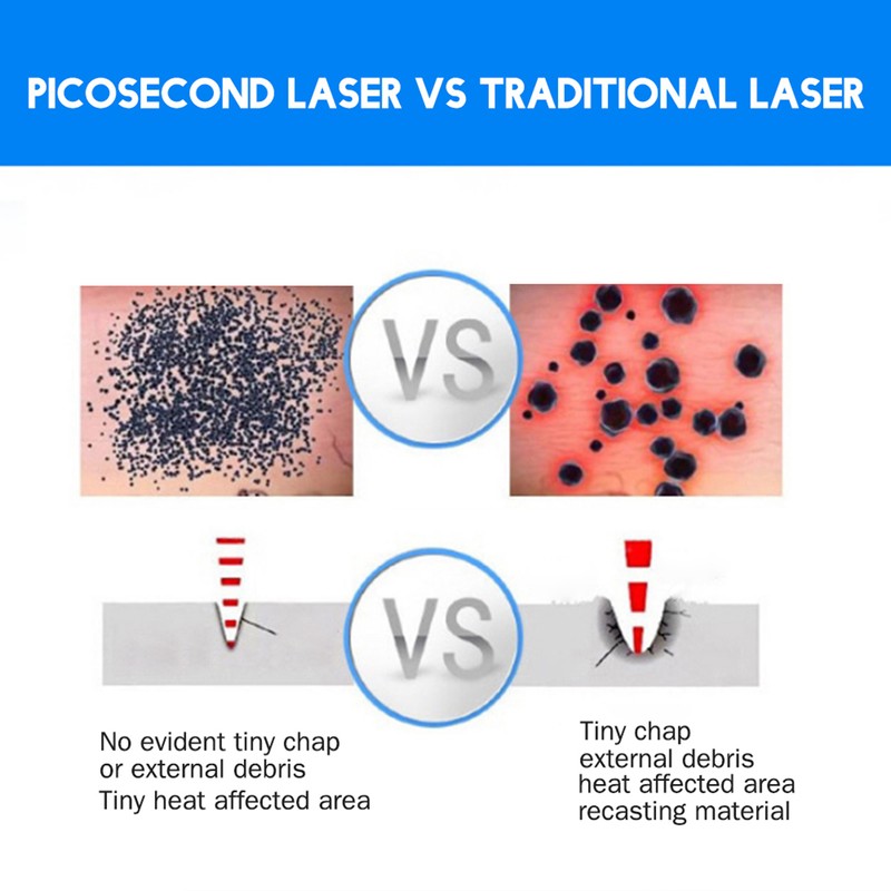Handheald Red Light Picosecond Laser Pen Scar Tattoo Removal Melanin