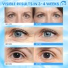 RONKIE Caffeine Eye Cream for Dark Circles: Caffeine Eye Stick