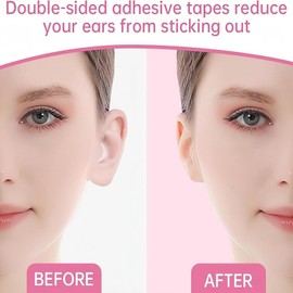 2PCS Cosmetic Ear Corrector,Waterproof Ear Stickers,Ear Tape for Big Ears,Ear Stickers Corrector,Ear Support Patches,Invisible Ear Patches,Ear Correctors,Invisible Ear Sticker,Ear Corrector Ear Tape