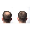 HairLab 100% Organic Hair-Thickening Keratin Fibres for Concealing Hair Loss