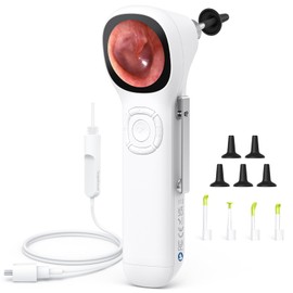 ScopeAround Digital Otoscope w/IPS Screen, 720p HD Smart Video Otoscope with Light, Ear Scope Otoscope with Camera Ear Wax Removal Camera, Ear Checker, Power On and Go, White