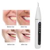 Intelligent Ultrasonic Electric Dental Scaler Dental Calculus Plaque Tartar Remover