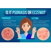 MercyBocu Eczema Cream Relief - All Natural No Chemicals -