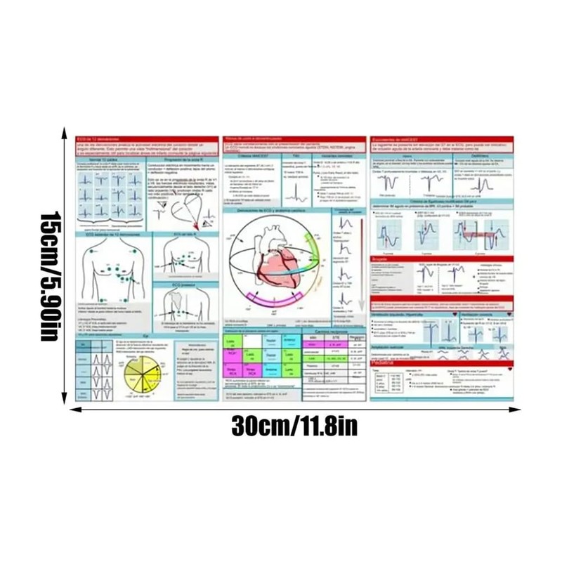 Aswalling Ecg Interpretation Pocket Card Horizontal & Vertical Layout Compact