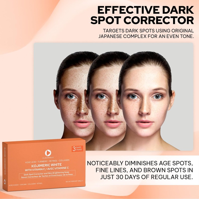 KOJIMERIC WHITE Kojic Acid Soap for Dark Spots – Skin