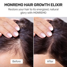 MONREMO Hair Growth Elixir with Turmeric, Caffeine & Biotin – Fast-Absorbing Regrowth & Scalp Treatment Serum for Fuller Hair – Lightweight Vegan Formula – Ideal for Thinning, Weak Hair & Daily Use