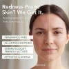Azelaic Acid 10% Serum For Face With Niacinamide &